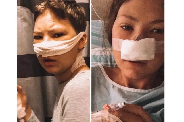    Лизе удалили некоторые органы из головы. Фото: Предоставлено героем публикации "АиФ-Новосибирск"