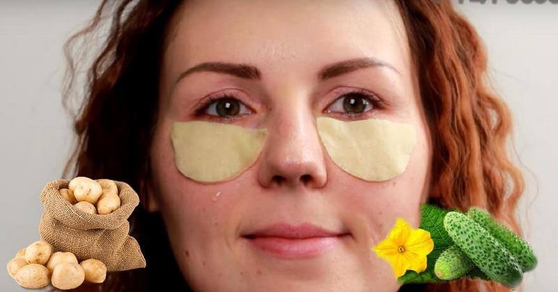 Как убрать мешки под глазами народными средствами?