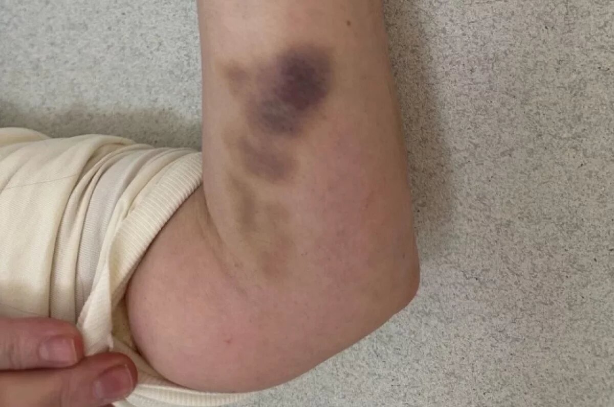    Дела нет: полиция игнорирует нападение на женщину во Владивостоке