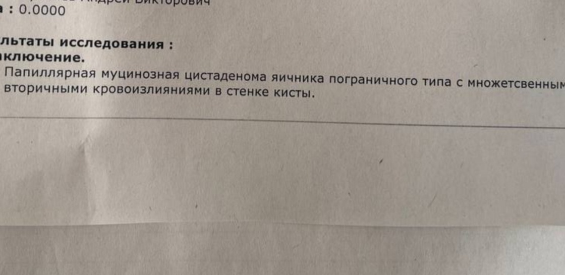 Вот такой вот "остеохондроз" поясничный.
