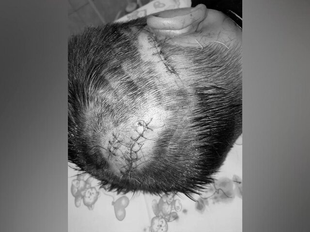    Фото: телеграм-канал "ГБУЗ МО "МОЦОМД"