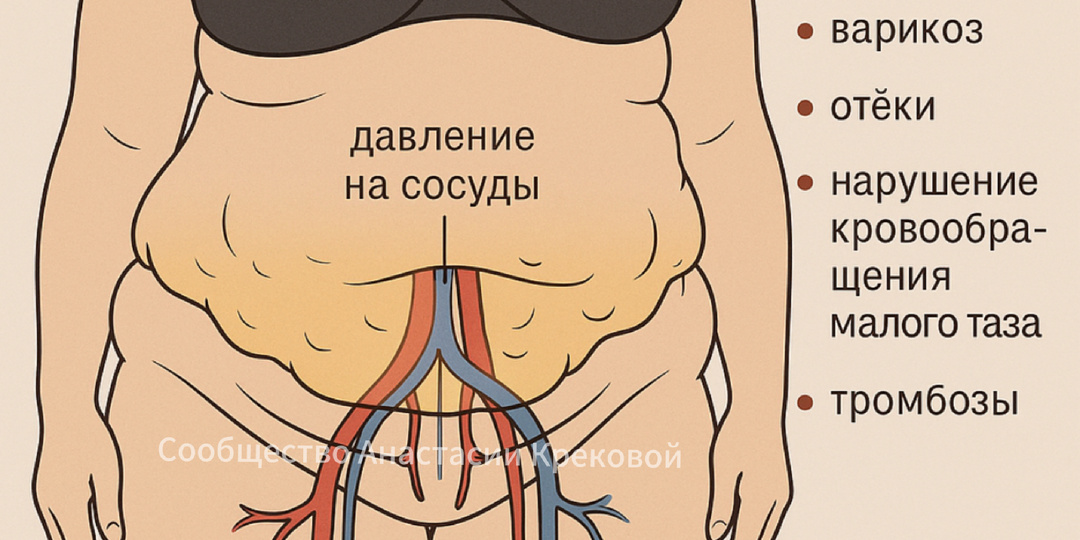 5 эффективных способов убрать жировой фартук у женщин