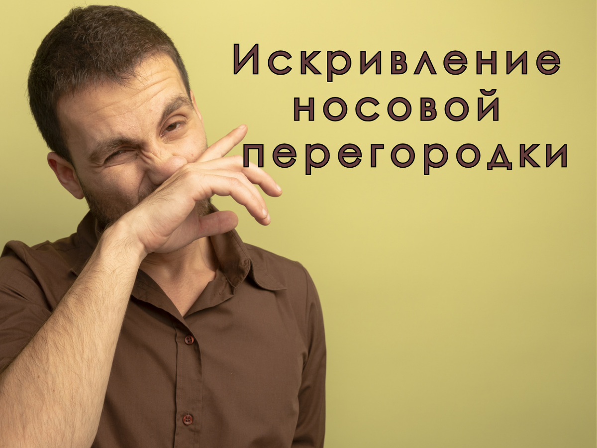 Искривление носовой перегородки