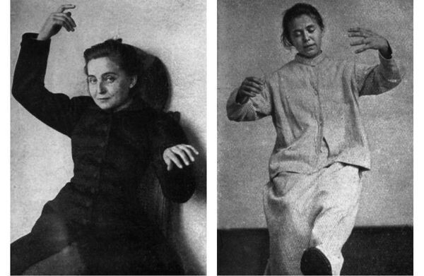 Фотография пациентки с кататонией взятая из свободных источников