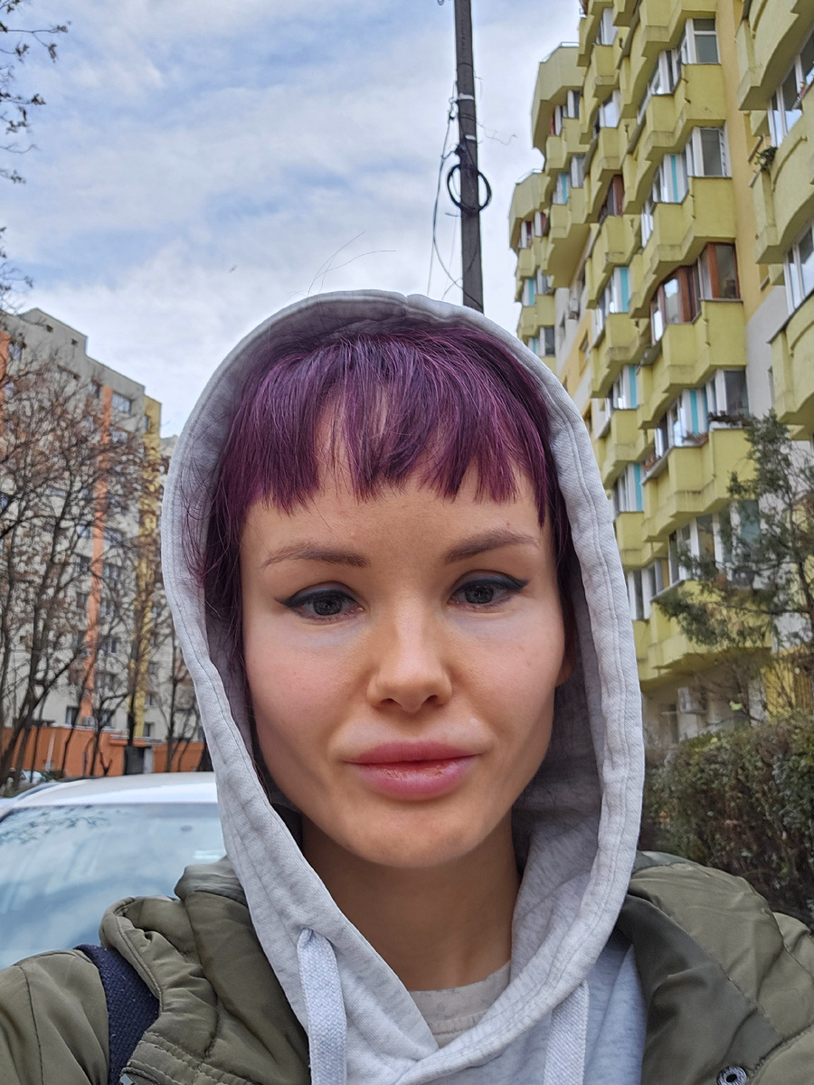 брови до процедуры удаления пикосекундным лазером, Бухарест, декабрь 2024