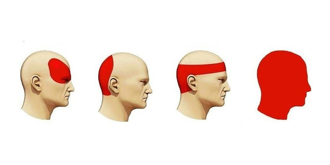 Самомассаж от головной боли