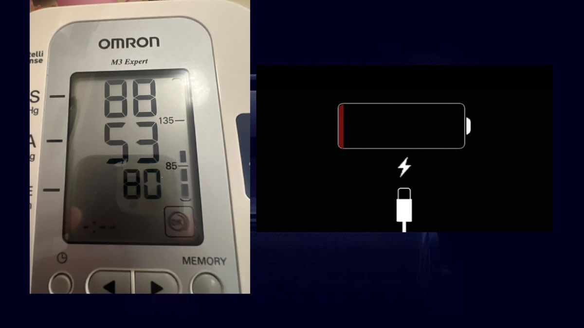 Давление оказалось вот таким низким, моё фото