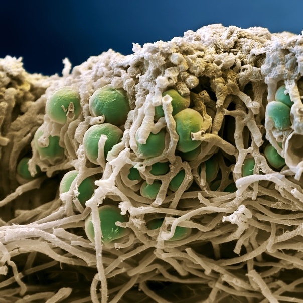 Ну вот так примерно лишайник выглядит при увеличении. Очень понятно сразу, где тут нити гриба, а где водоросли.