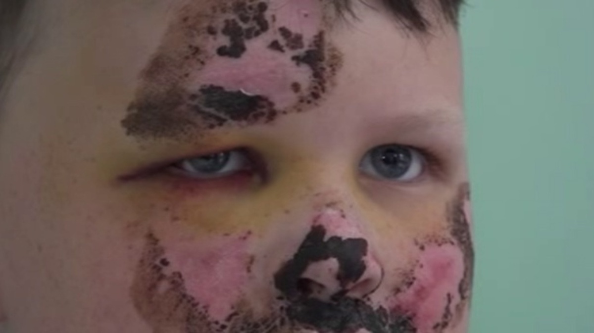    «Особенности детского травматизма в летний период» – репортаж «Вестей-Курск»