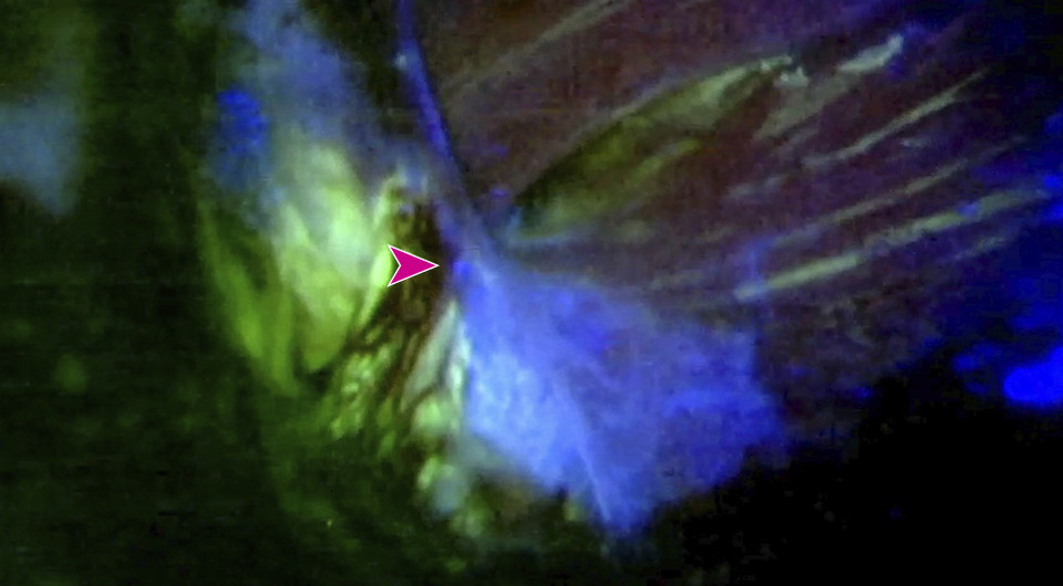   Samuel A. Gold / JAMA Surgery, 2025