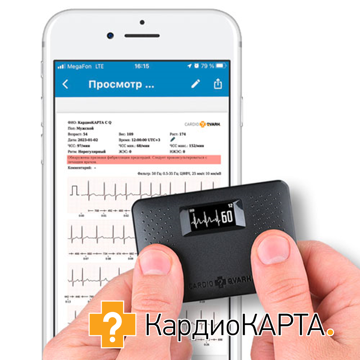 Компактное устройство для регистрации ЭКГ в домашних условиях "КардиоКАРТА".