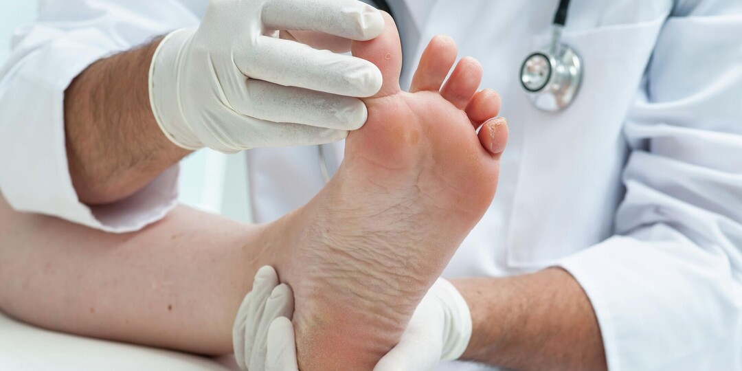 Полинейропатия: причины, симптомы, лечение и восстановление