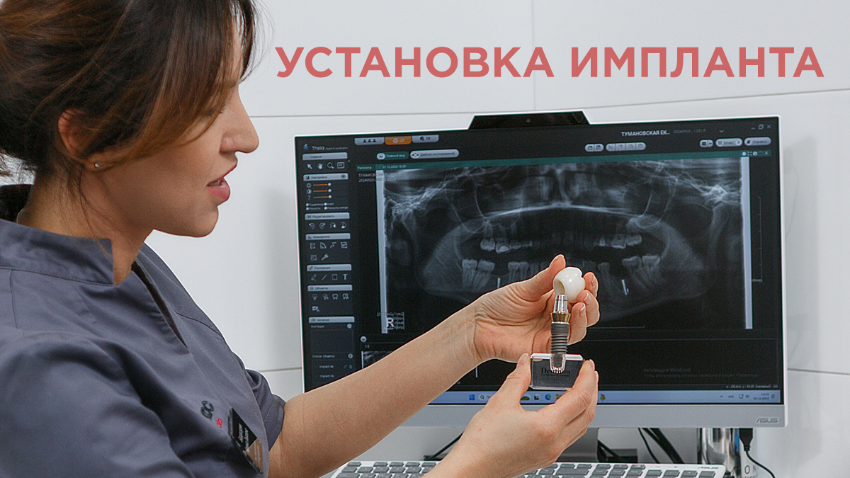 Бесплатная консультация стоматолога хирурга-имплантолога в Москве в сети стоматологических клиник «КДС Дентал»