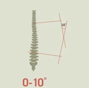 🤔ПОЧЕМУ ВАЖНО СОВМЕЩАТЬ НОШЕНИЕ КОРСЕТА И КОРРИГИРУЮЩУЮ ГИМНАСТИКУ?🤔