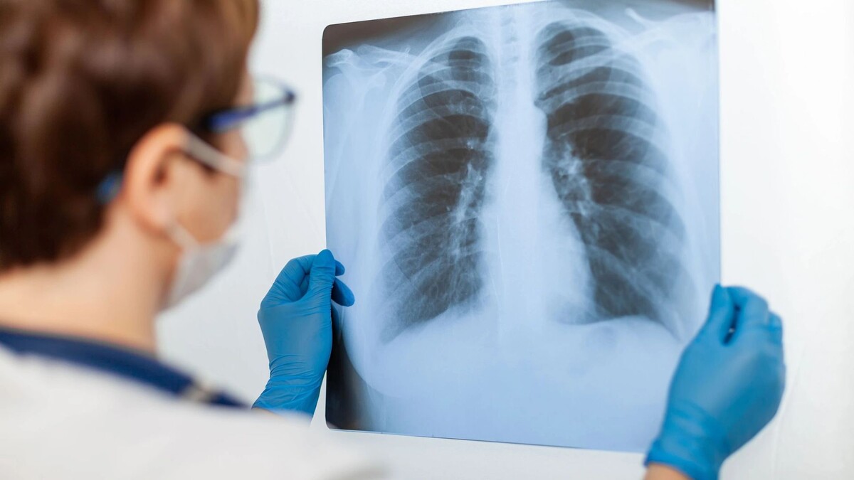    Фото: Shark9208888/Shutterstock/Fotodom