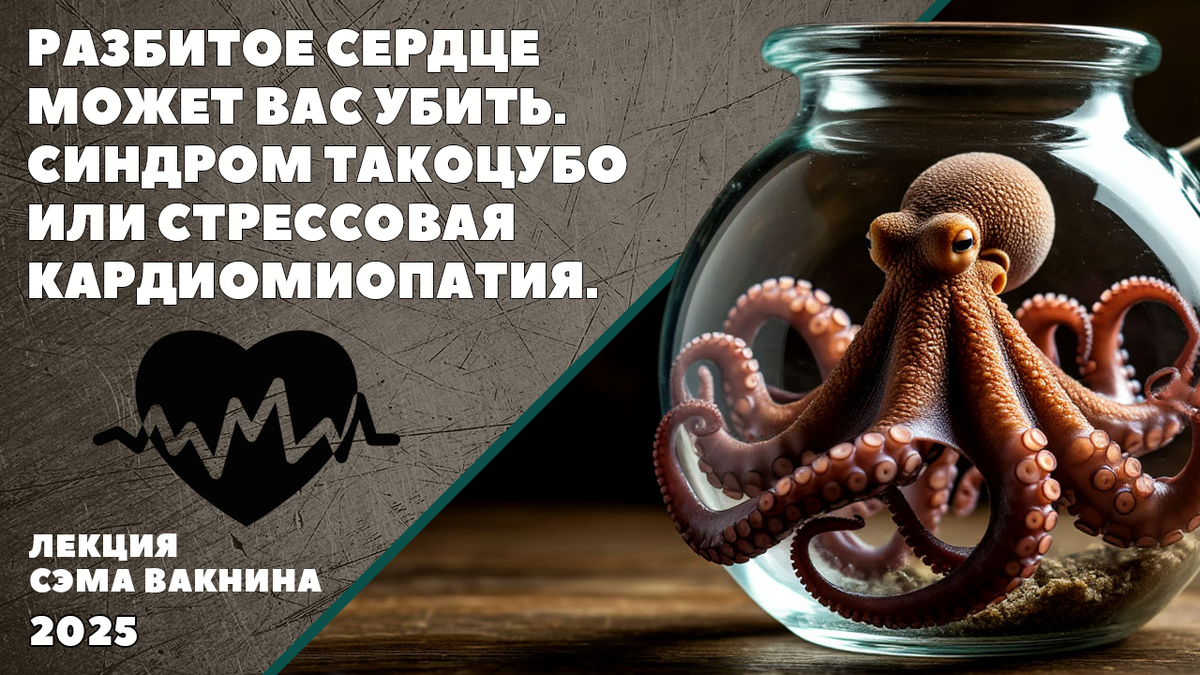 РАЗБИТОЕ СЕРДЦЕ МОЖЕТ ВАС УБИТЬ. СИНДРОМ ТАКОЦУБО ИЛИ СТРЕССОВАЯ КАРДИОМИОПАТИЯ.