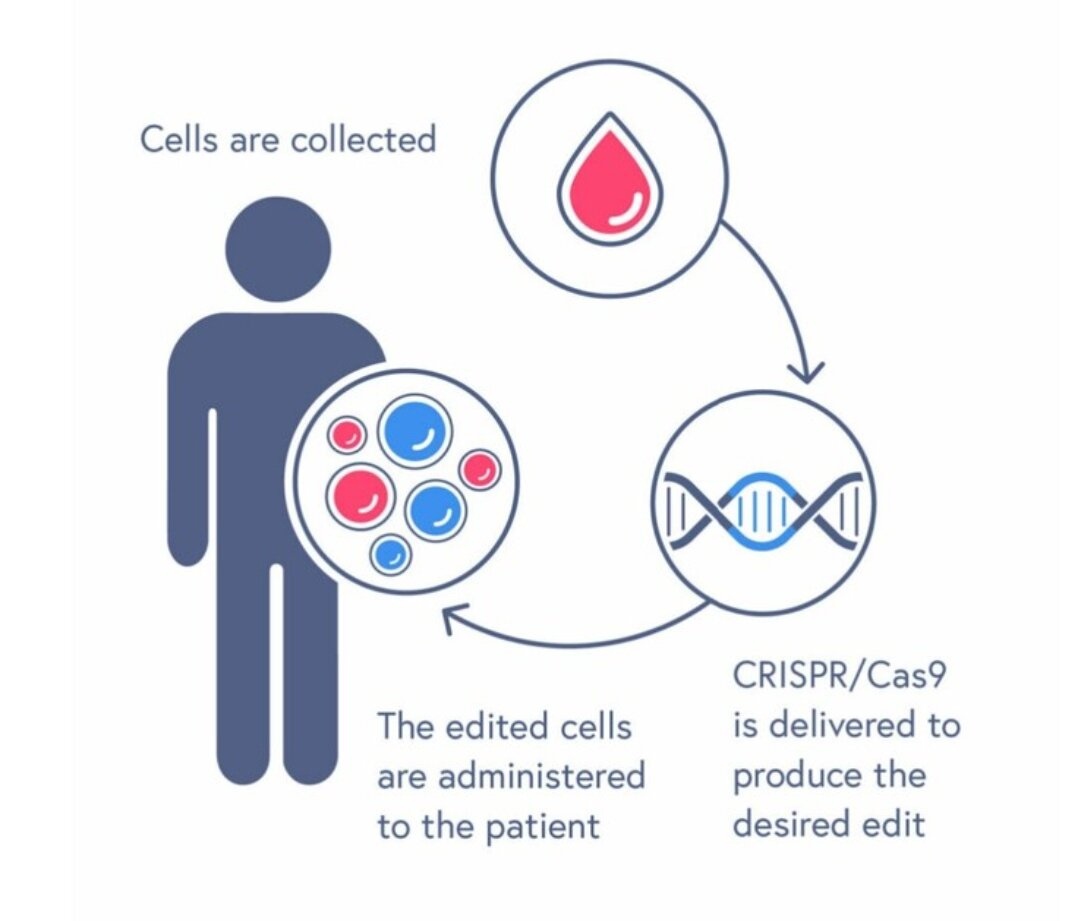 Casgevy. Схема с указанием, где конкретно используется CRISP/Сas9.