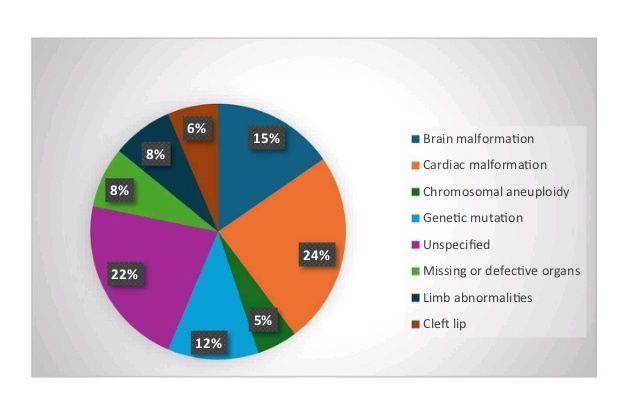 Наиболее распространенные аномалии развития