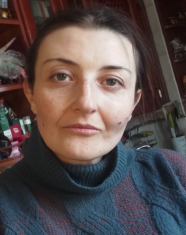 По моему, в 43 года неплохой результат ухода. После развода в 21 году я обеспокоилась состоянием кожи. Я придумала свою систему ухода, научилась сама готовить косметику, много узнала о косметике и решила поделиться, наконец. Конечно, про напряжение подбородка и лба нужно говорить отдельно - это уже компетенция не крема. Сохранять сухую кожу особенно трудно - она крайне капризная и чувствительная к изменениям окружающей среды. 