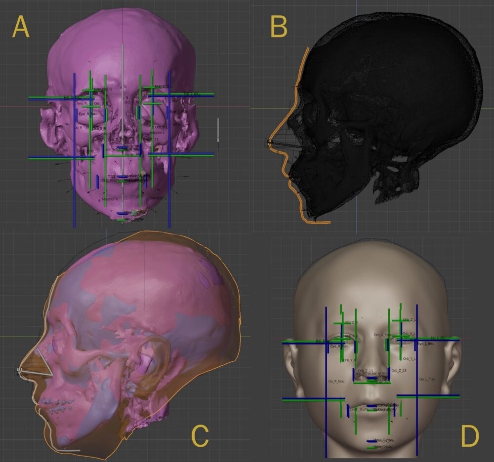    Фото: https://ortogonline.com