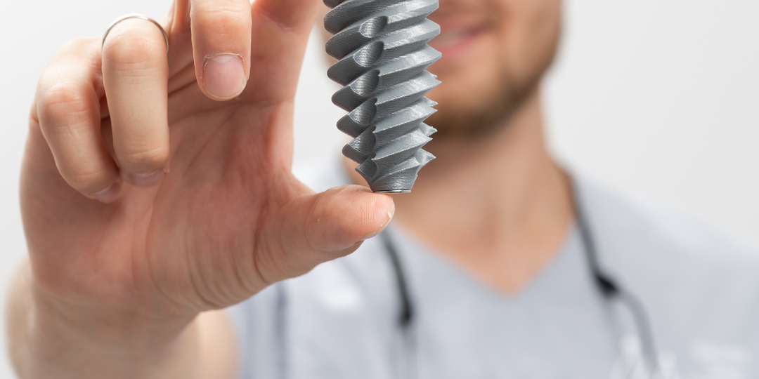 Какой имплантат выбрать?