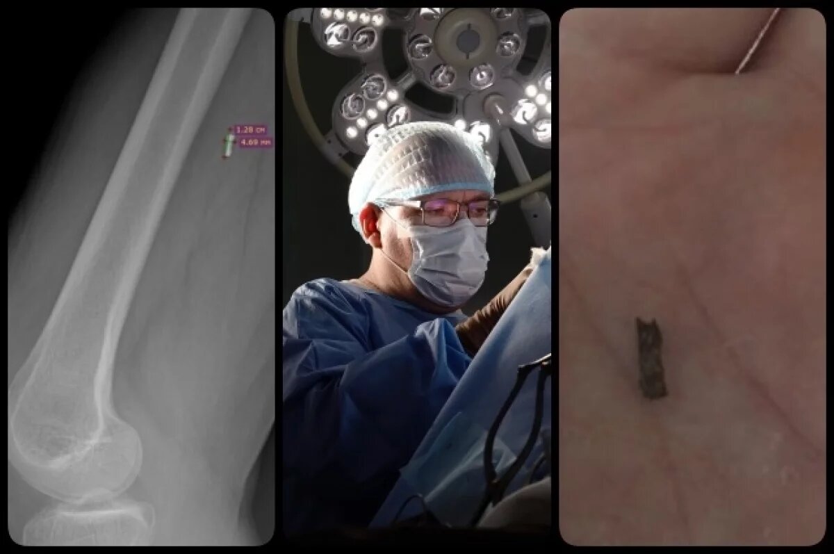    Депутат Новосибирского горсовета получил ранение на СВО