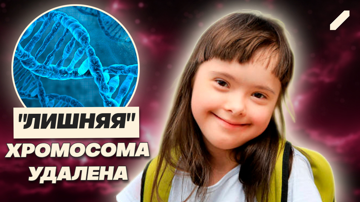 Учёные вырезали синдром Дауна из ДНК: звучит как фантастика, но это реальность