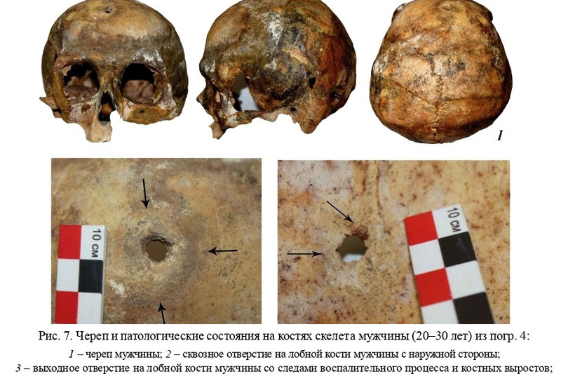    Боевое ранение сармата (иллюстрация: «Нижневолжский археологический вестник»)