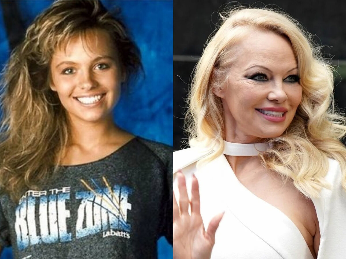 Посмотрите на высокий лоб, на нос. Нос очень смягченный. 