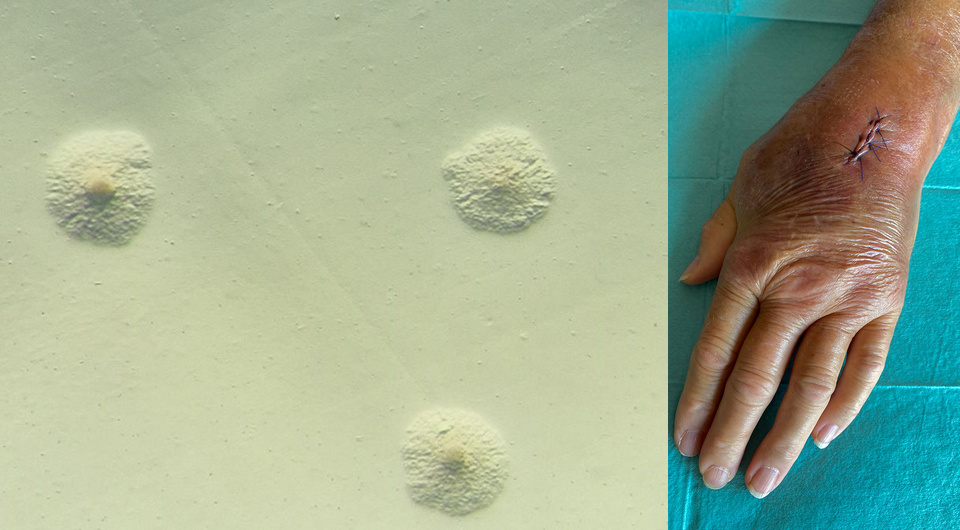   Tjaša Vivoda et al. / Emerging Infectious Diseases, 2025