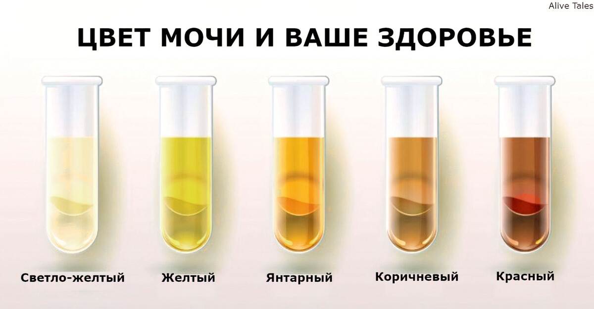 О чём говорит тёмный цвет мочи — 5 возможных серьёзных причин: Моя история