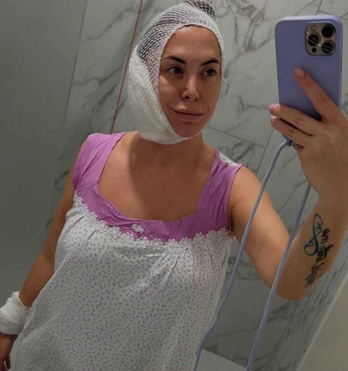 Наталья Фриске после операции на лимфоузеле. Фото: соцсети