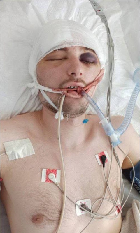    После задержания ТЦК в больнице скончался мобилизованный волонтёр