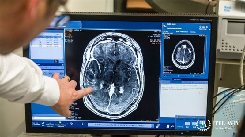 Ранние симптомы опухоли мозга: как не пропустить тревожные сигналы организма