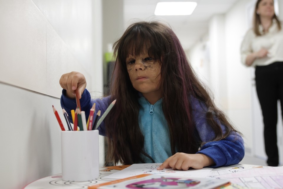    Девочка "с маской Бэтмена" успешно перенесла главную операцию в жизни. Снимок архивный. Вероника ОВСЯННИКОВА