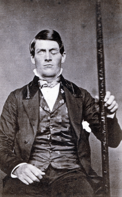 Финеас Гейдж и лом, который нанес повреждение.