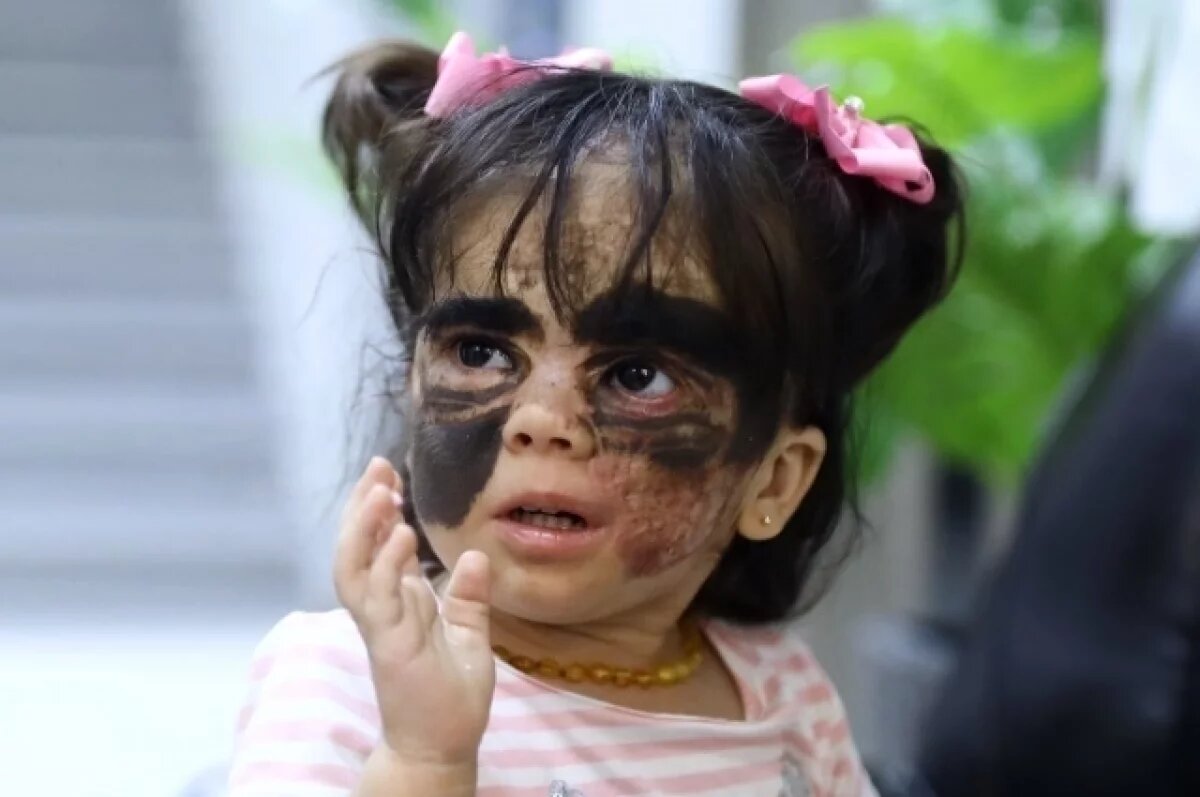    Американской девочке в «маске Бэтмена» сделали новую операцию в Петербурге