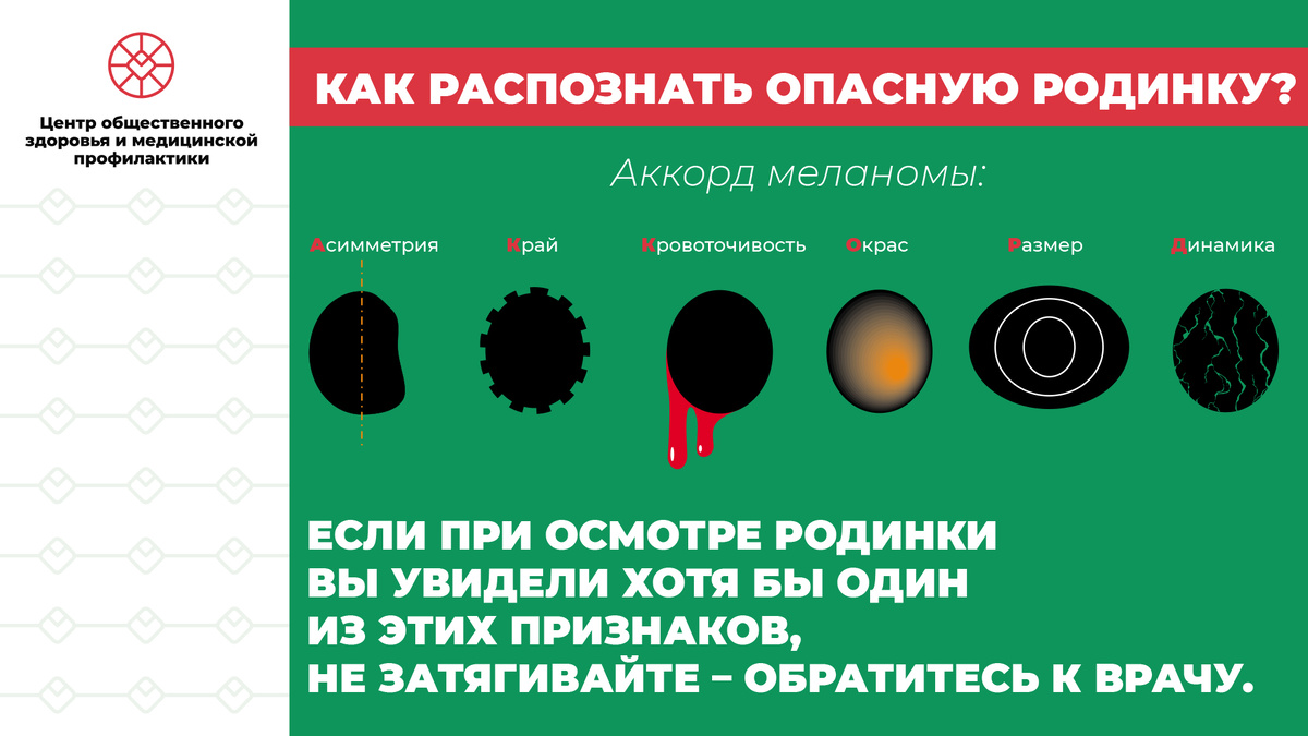 Родинка изменилась? Когда нужно срочно бежать к онкологу