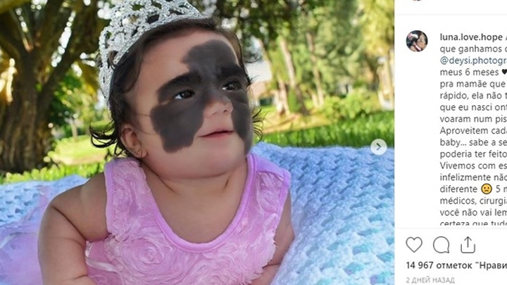    Так Луна выглядела до проведения операций. Скриншот: соцсети/luna.love.hope