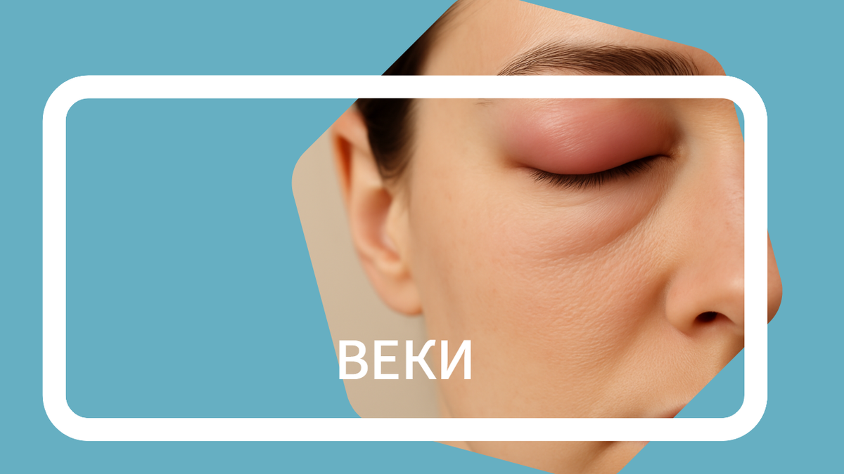 Отёк век после ботокса