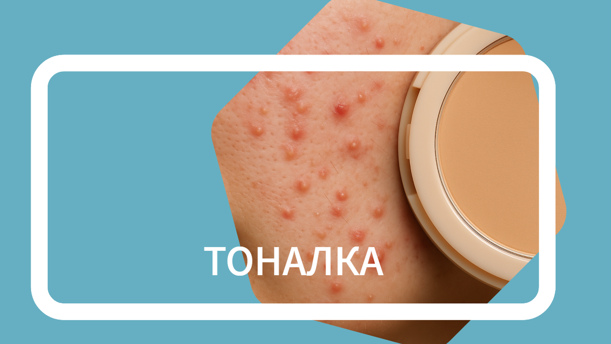 Прыщи от тонального крема