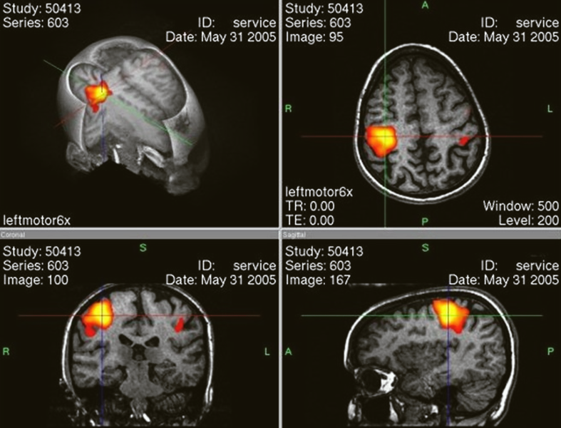 Разные участки мозга активируются в зависимости от того, чем мы заняты — и это нормально