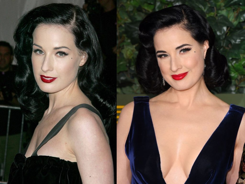 Дита фон Тиз