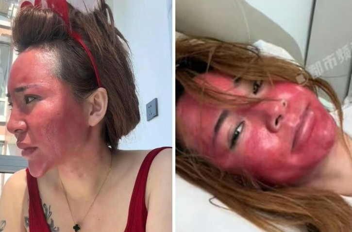 На самом деле у нее более китайское лицо, просто его раздуло