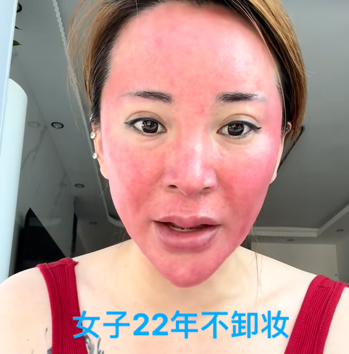 Вот фронтальное фото, но губы опухли или сделаны?