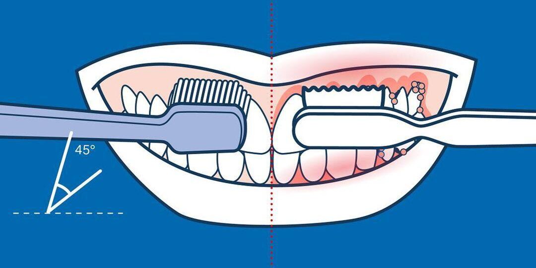 Жесткая или мягкая?