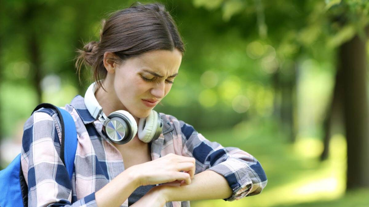    Укусы комаров могут быть опасны особенно для тех, кто подвержен аллергии и дерматиту / Фото: Shutterstock