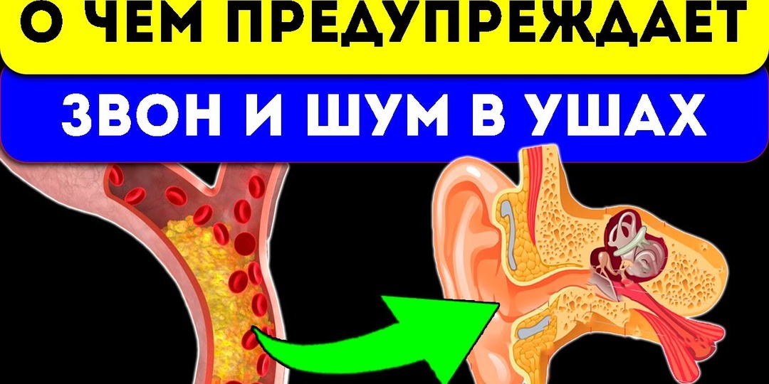 Почему постоянный шум в ушах может быть признаком опухоли