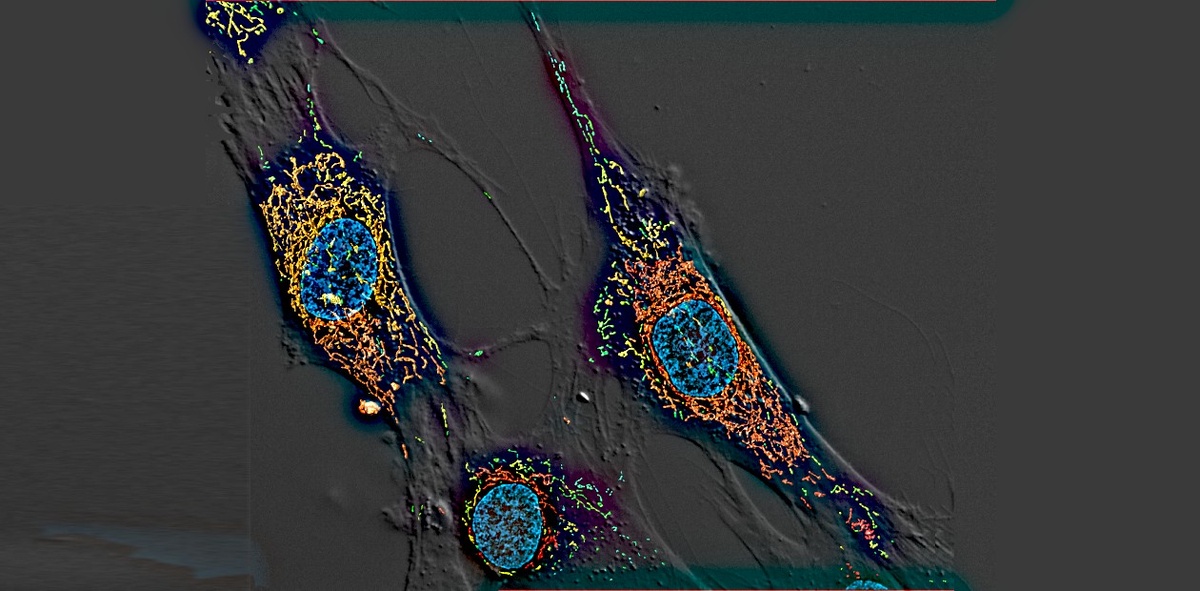 Фибробласты, клетки соединительной ткани человека. Митохондриальные сети клеток окрашены в разные цвета, ядра – синим цветом. © CC BY-NC 2.0/Glyn Nelson
