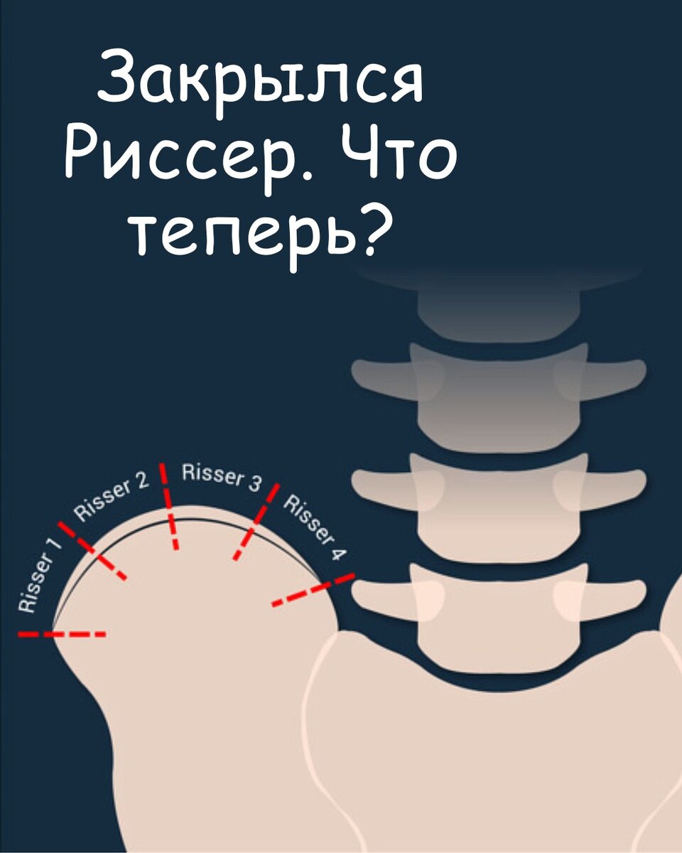 Закрылся Риссер. Что теперь?